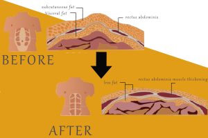 NUBWAY | Why MUSCULPTING machine is becoming more and more popular?