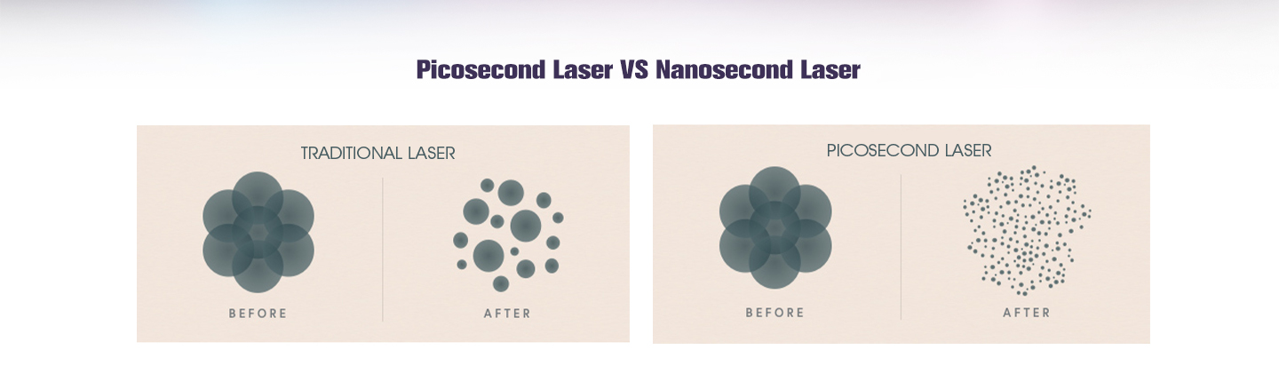 NUBWAY | Picosecond Laser Machine