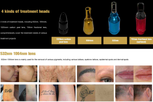 NUBWAY | What is a ND YAG Laser?
