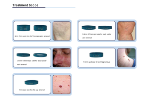 NUBWAY | What is 980nm Diode Laser Machine?