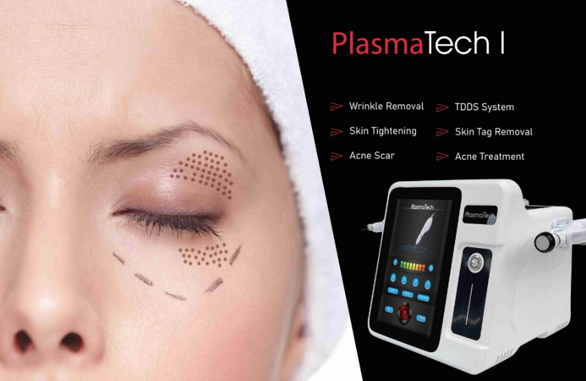 NUBWAY | How Often Should I Do Plasma on the Face?