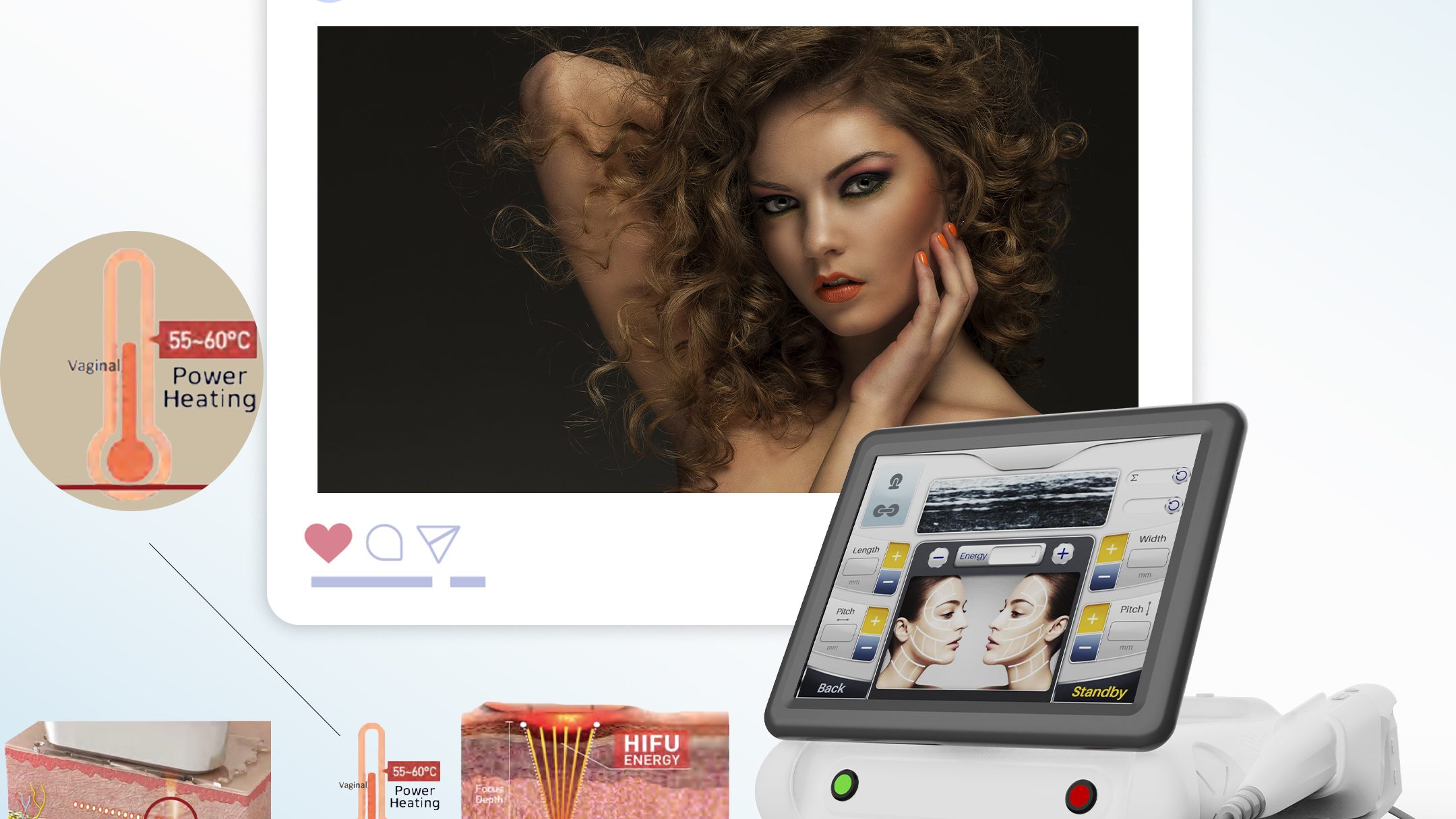 20230104 hifu(整）