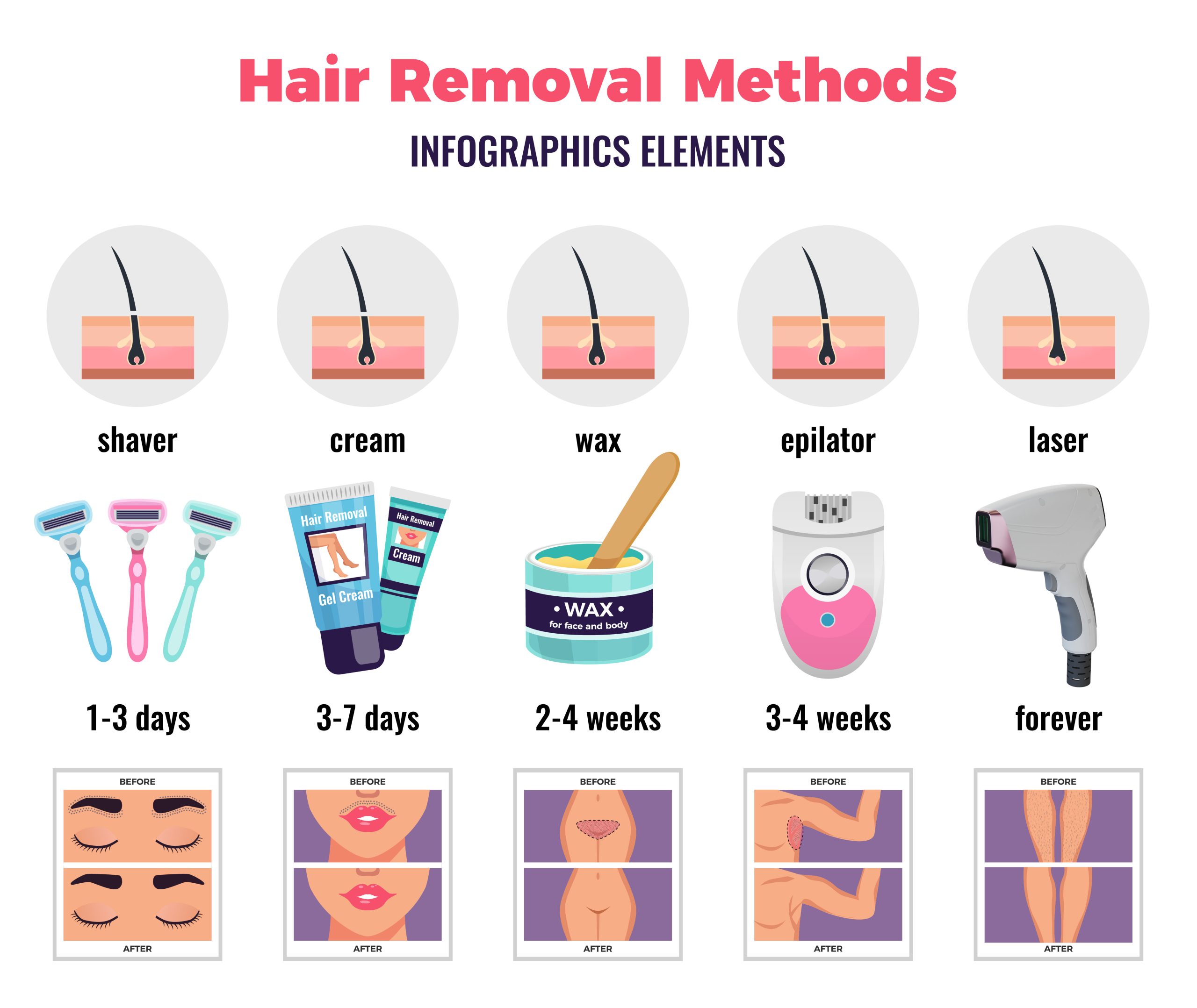 NUBWAY | The Ultimate Guide to Achieving Smooth Skin with Diode Laser Hair Removal