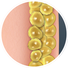 NUBWAY | Fat Freezing Unveiled: Evidence-Based Analysis of Cryolipolysis Effectiveness