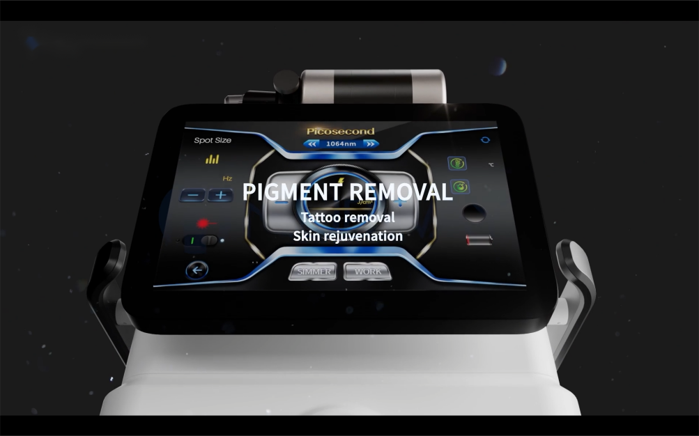 NUBWAY | Which laser is best for pigmentation?