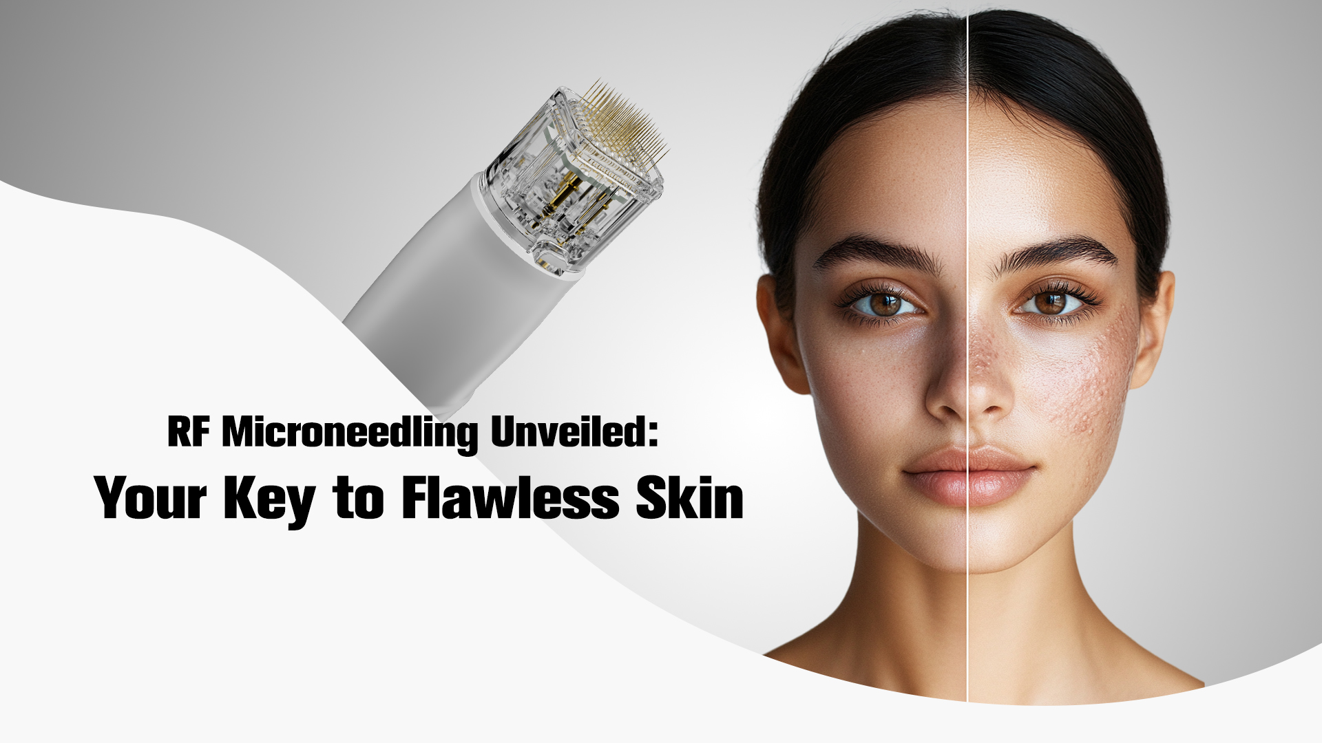 RF Microneedling Unveiled Your Key to Flawless Skin
