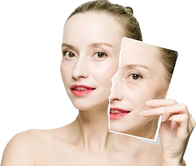 NUBWAY | Application of radio frequency(RF) in skin beauty