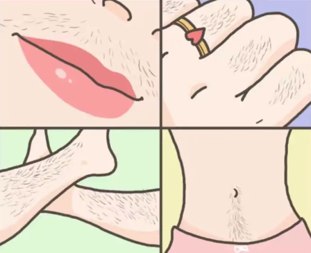Laser Hair Removal: A Safe and Effective Method for Hair Removal-