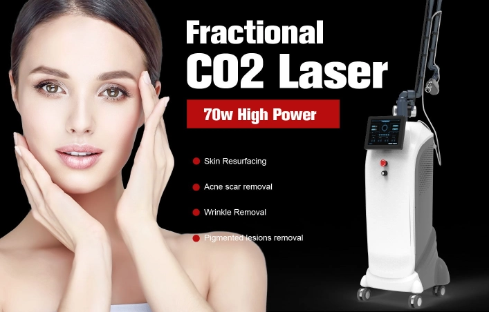 How Painful Is a CO2 Laser Treatment?-