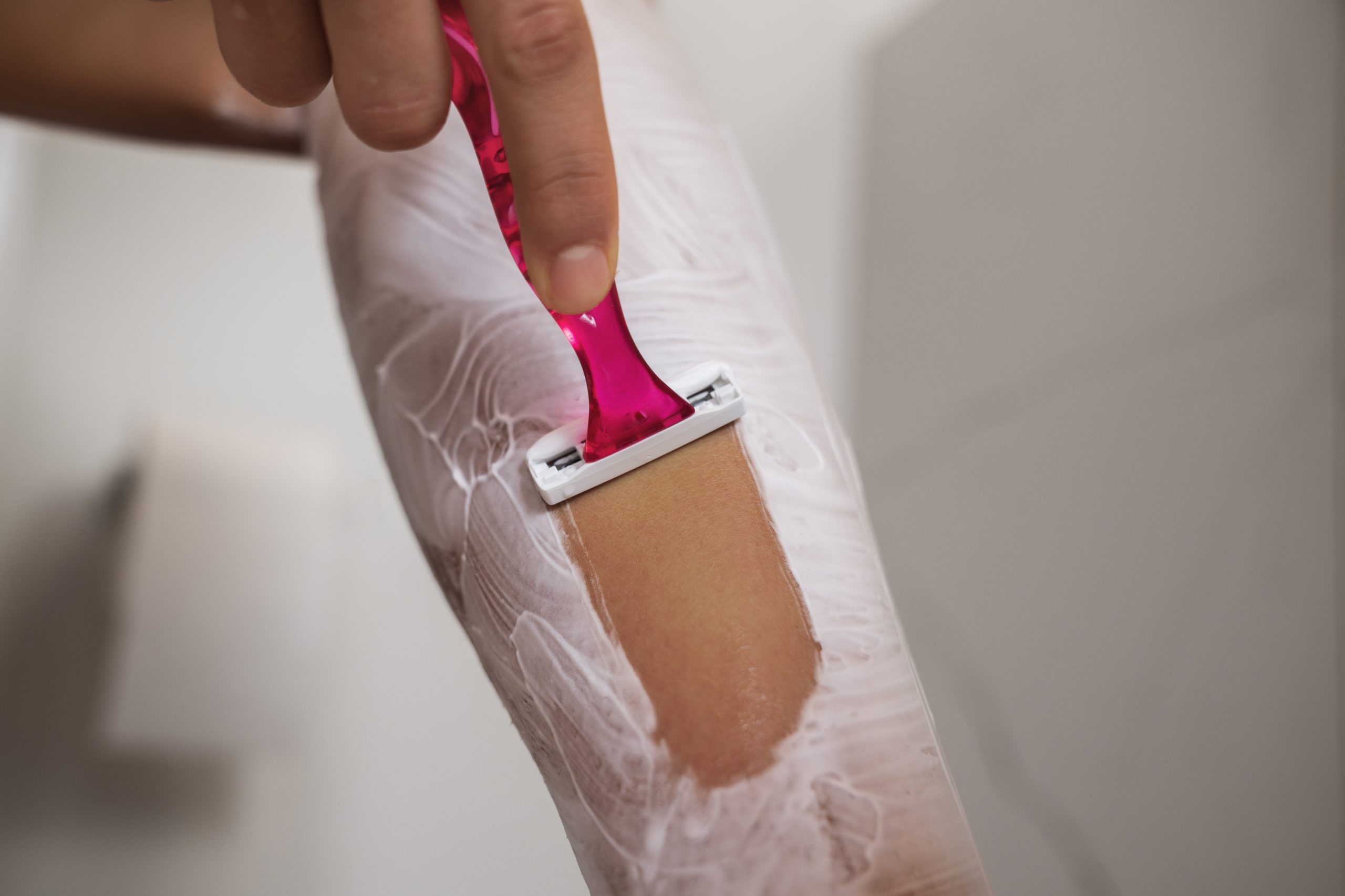 NUBWAY | Several things you must know about diode laser hair removal