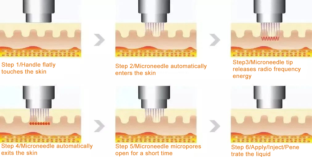 How Should You Take Care of Your Skin in Winter?-