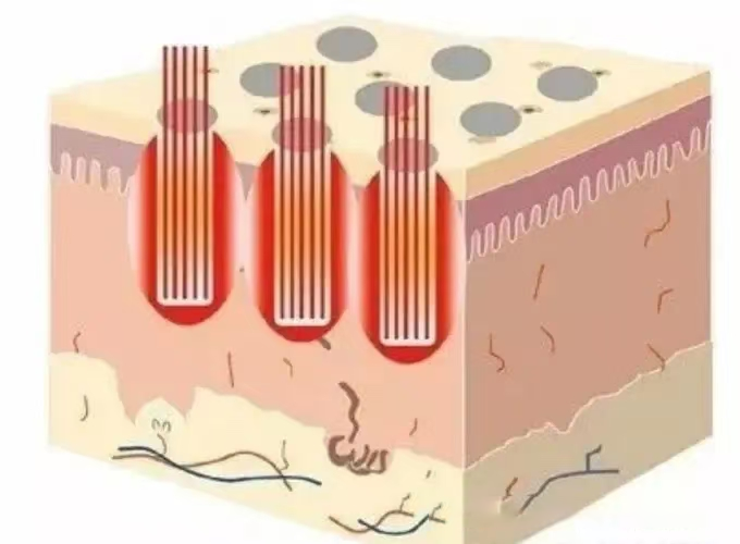 NUBWAY | How Should You Take Care of Your Skin in Winter?