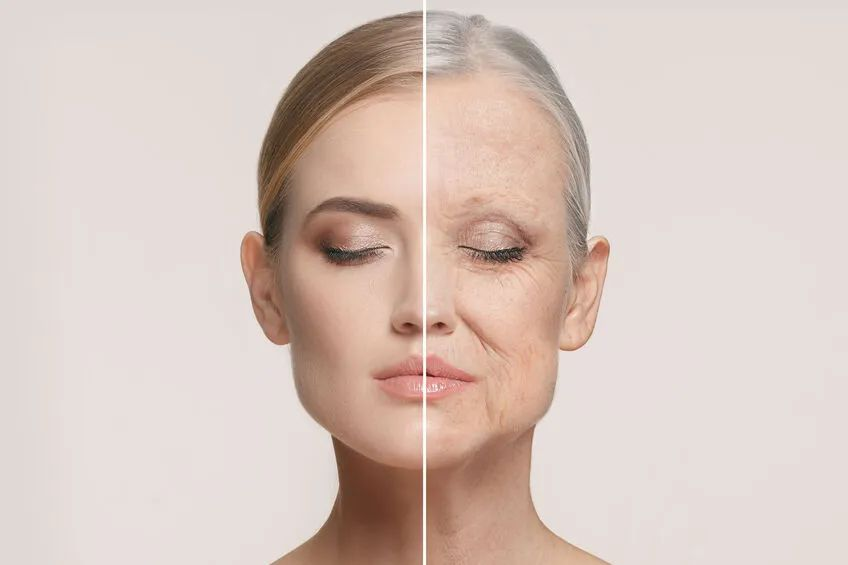 NUBWAY | HIFU Treatment: Measuring the Duration of Facial Tightening Results