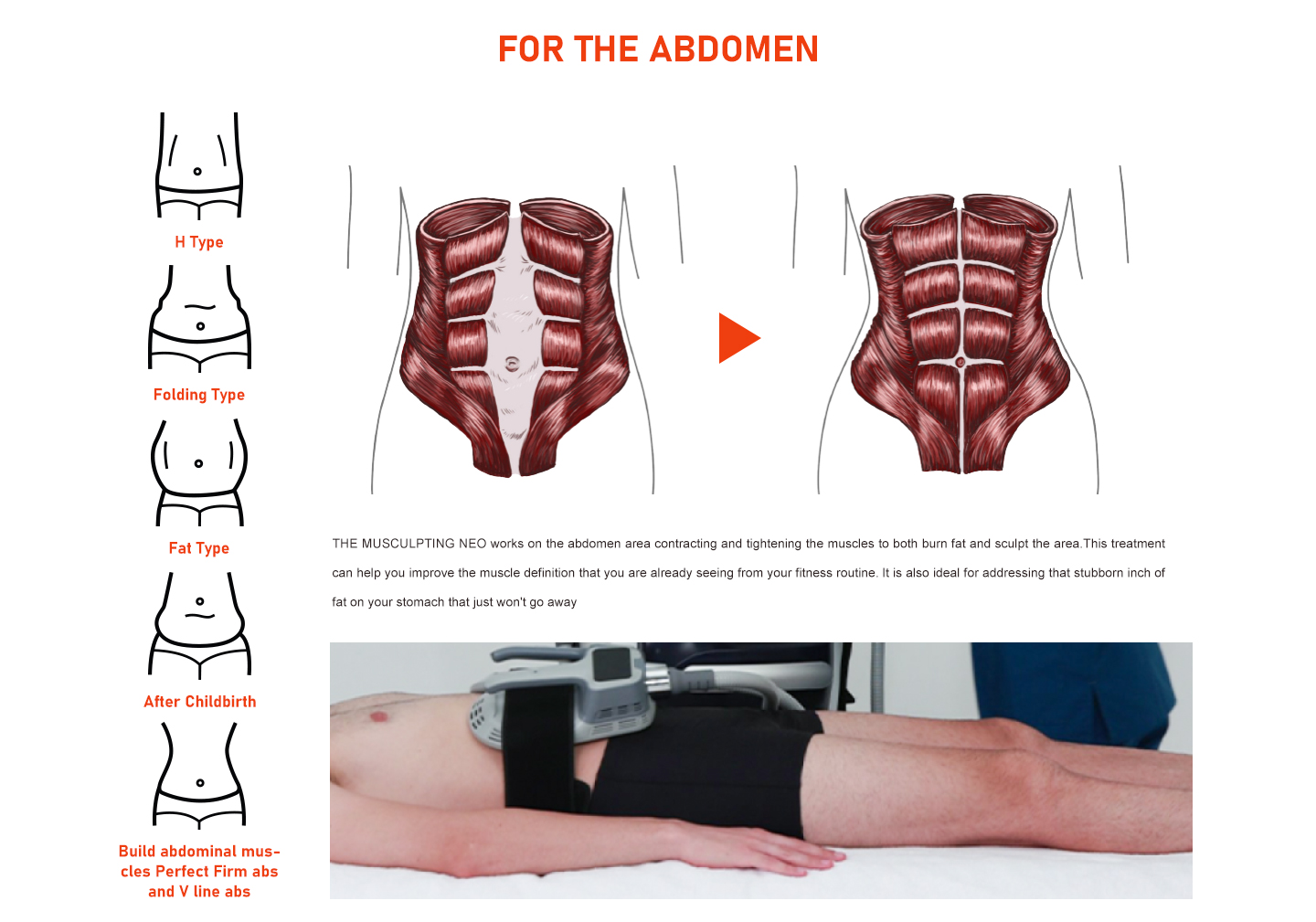 NUBWAY | Duration of EMS Sculpting Effects: What to Expect
