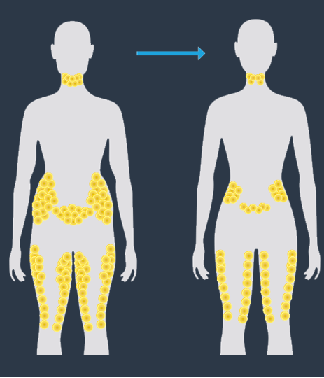 NUBWAY | Home Use Coolsculpting Machines: Are They Available for Purchase?