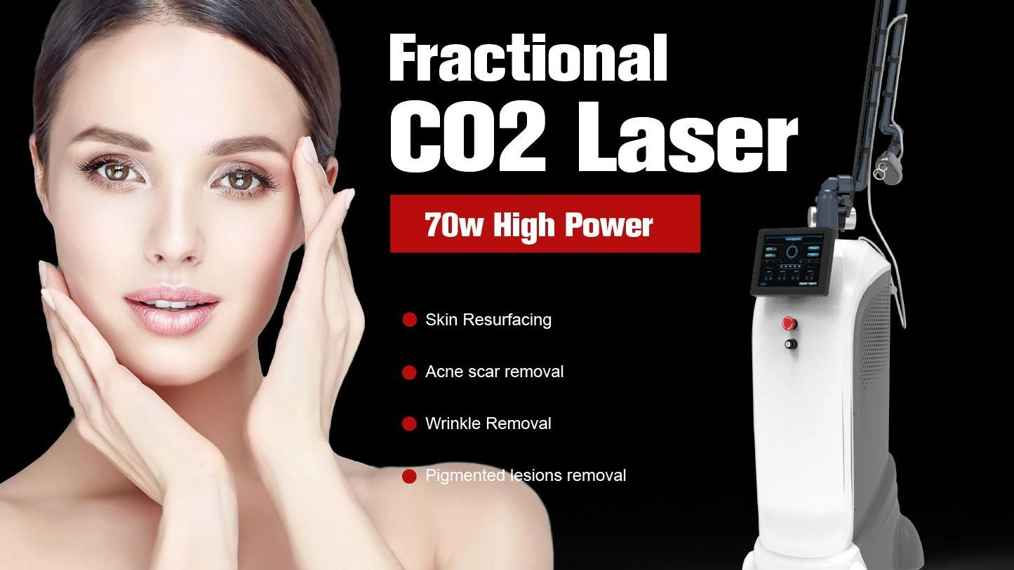 CO2 laser treatment