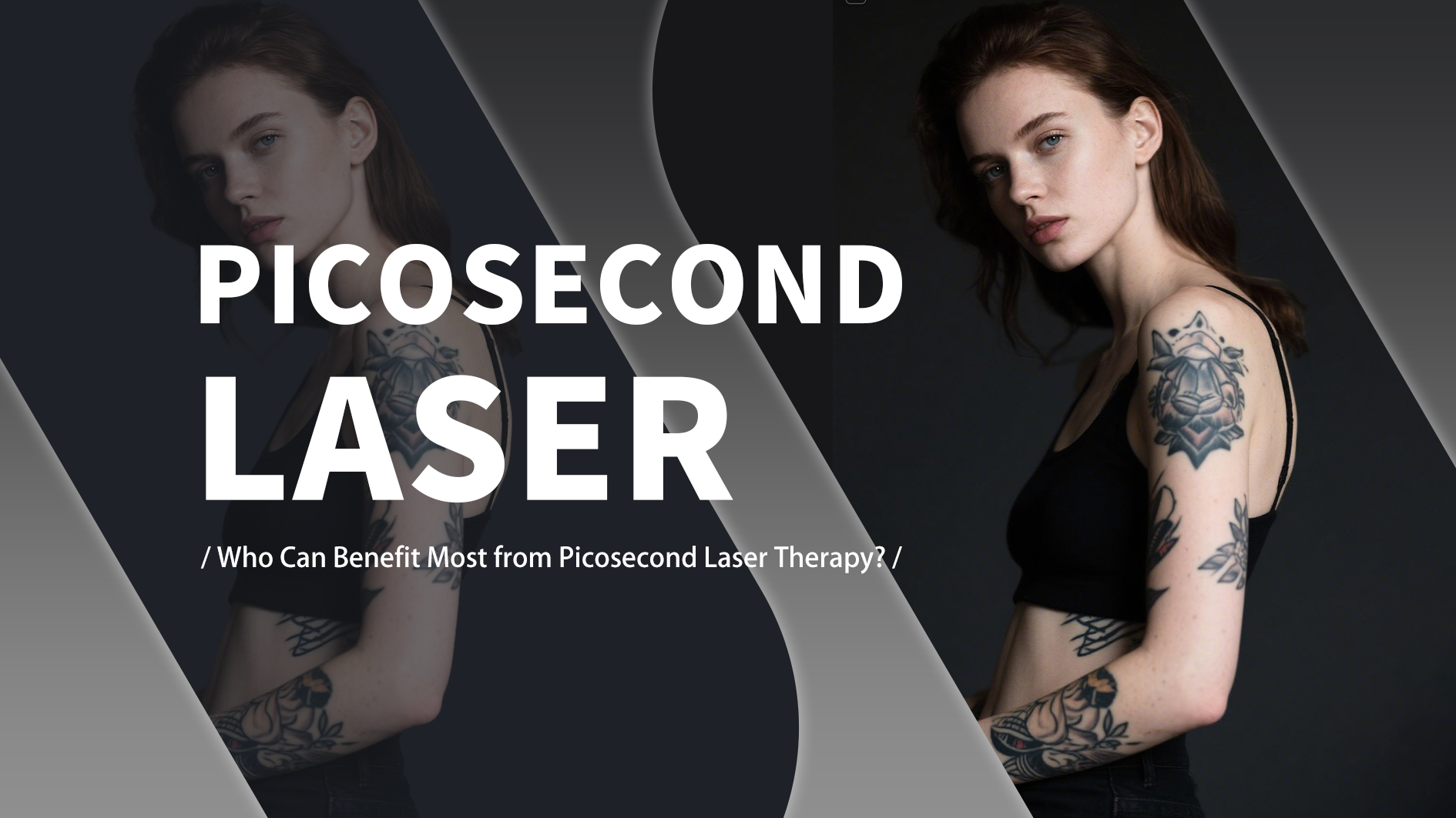 Who Can Benefit Most from Picosecond Laser Therapy