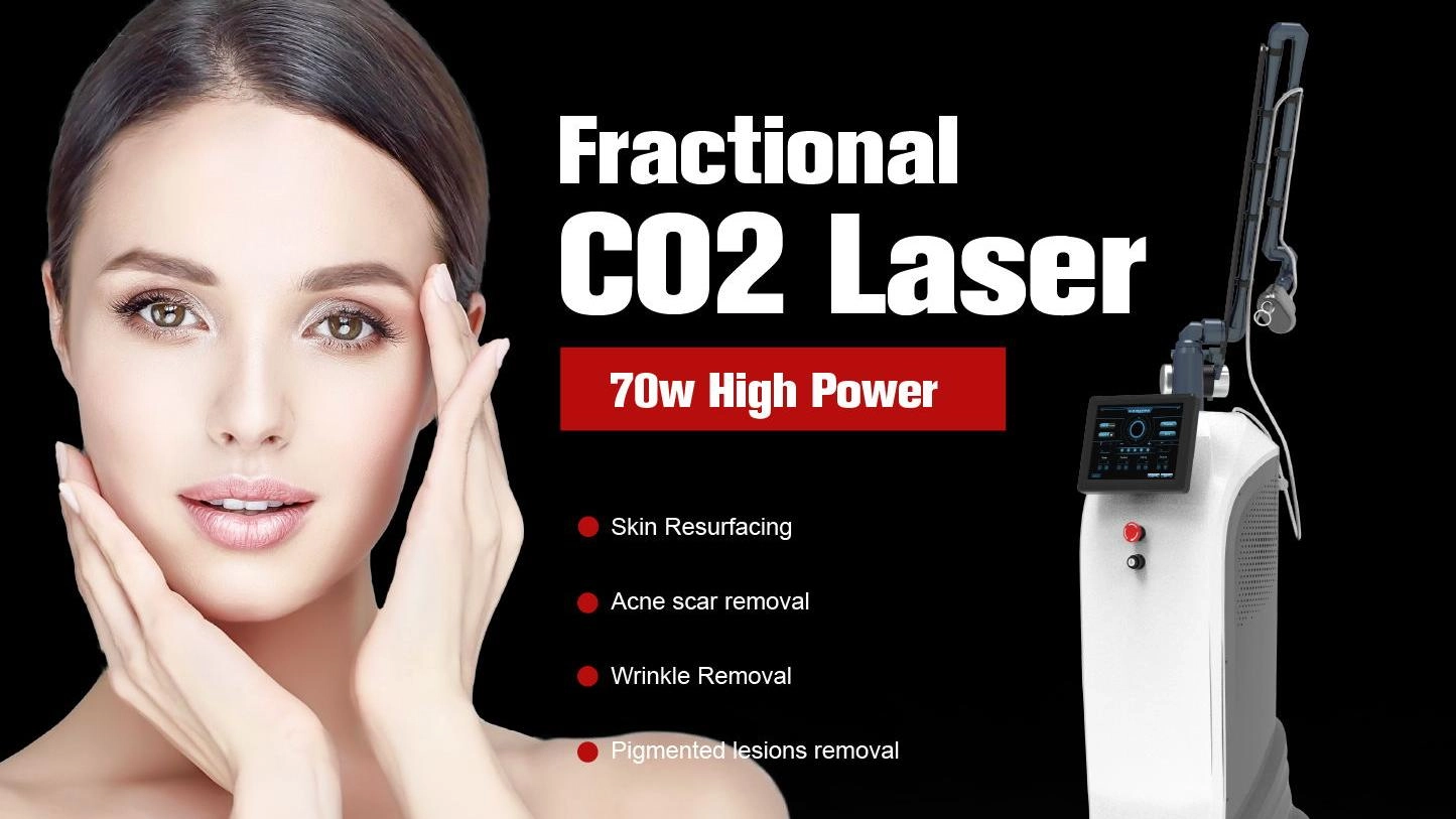 CO2 laser machine troubleshooting guide(1)