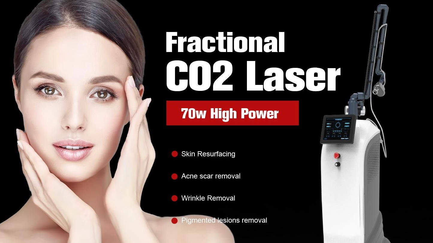 CO2 laser treatment(1)