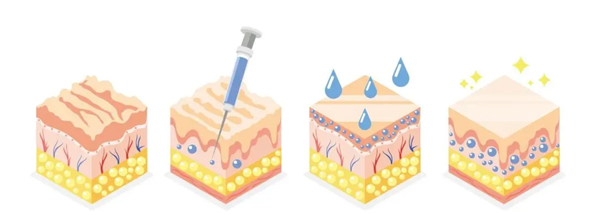 Hydro-Glo Injection: The Secrets and Practice of Scientific Skincare-