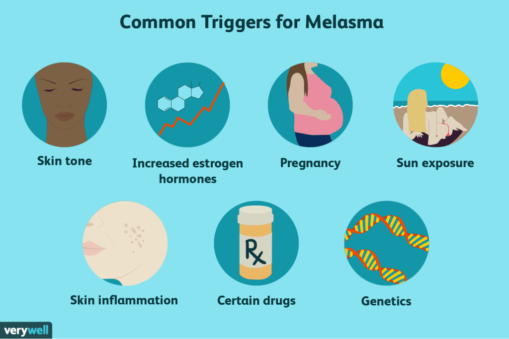 Melasma Treatment: Why Does It Sometimes Worsen? -