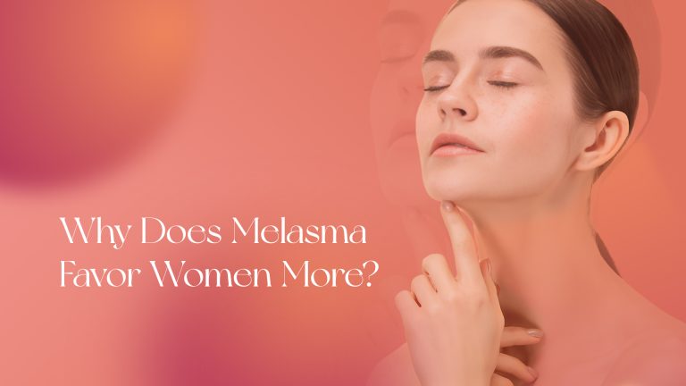 Why Does Melasma Favor Women More