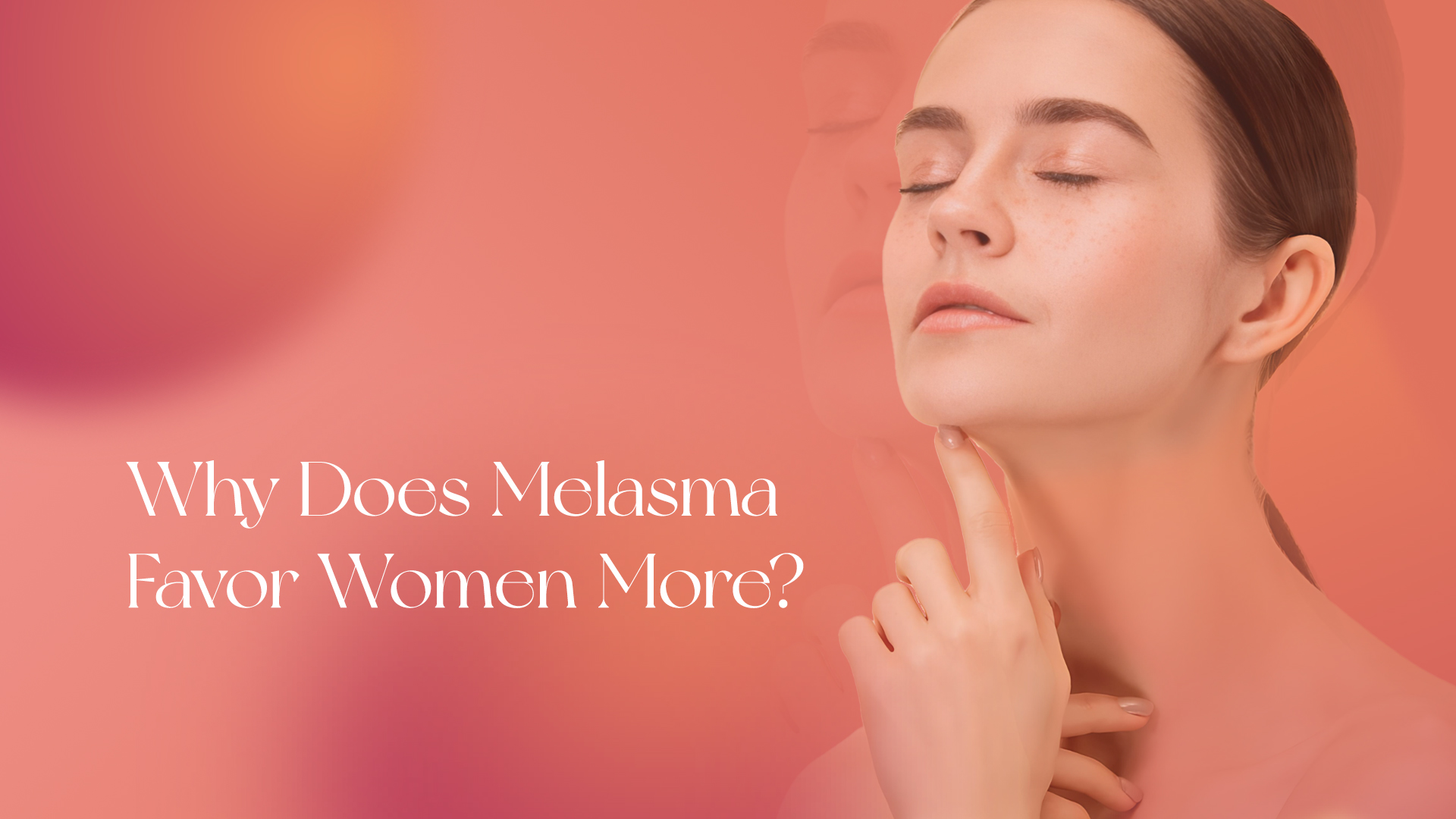 Why Does Melasma Favor Women More