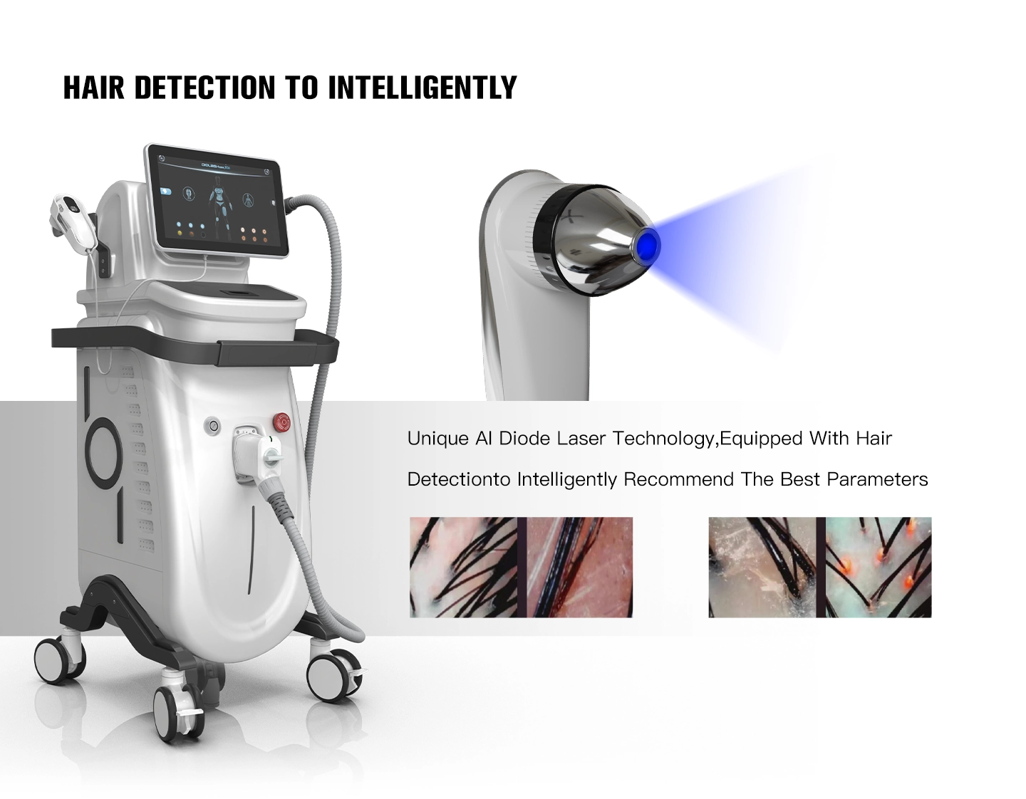 808nm “Gold Standard”: Why Diode Lasers Beat IPL on Speed, Safety, and Comfort-1