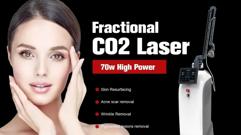 CO2 Fractional Laser Machine What Affects the Number of Sessions You Need