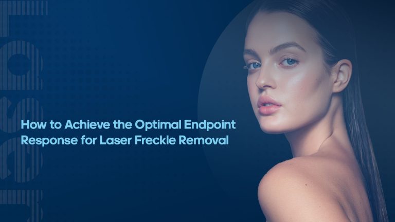 How to Achieve the Optimal Endpoint