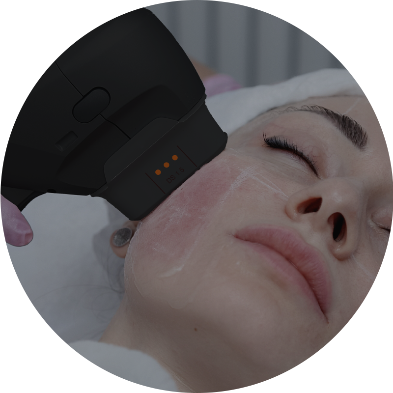 NUBWAY | HIFU（MPT）Machine