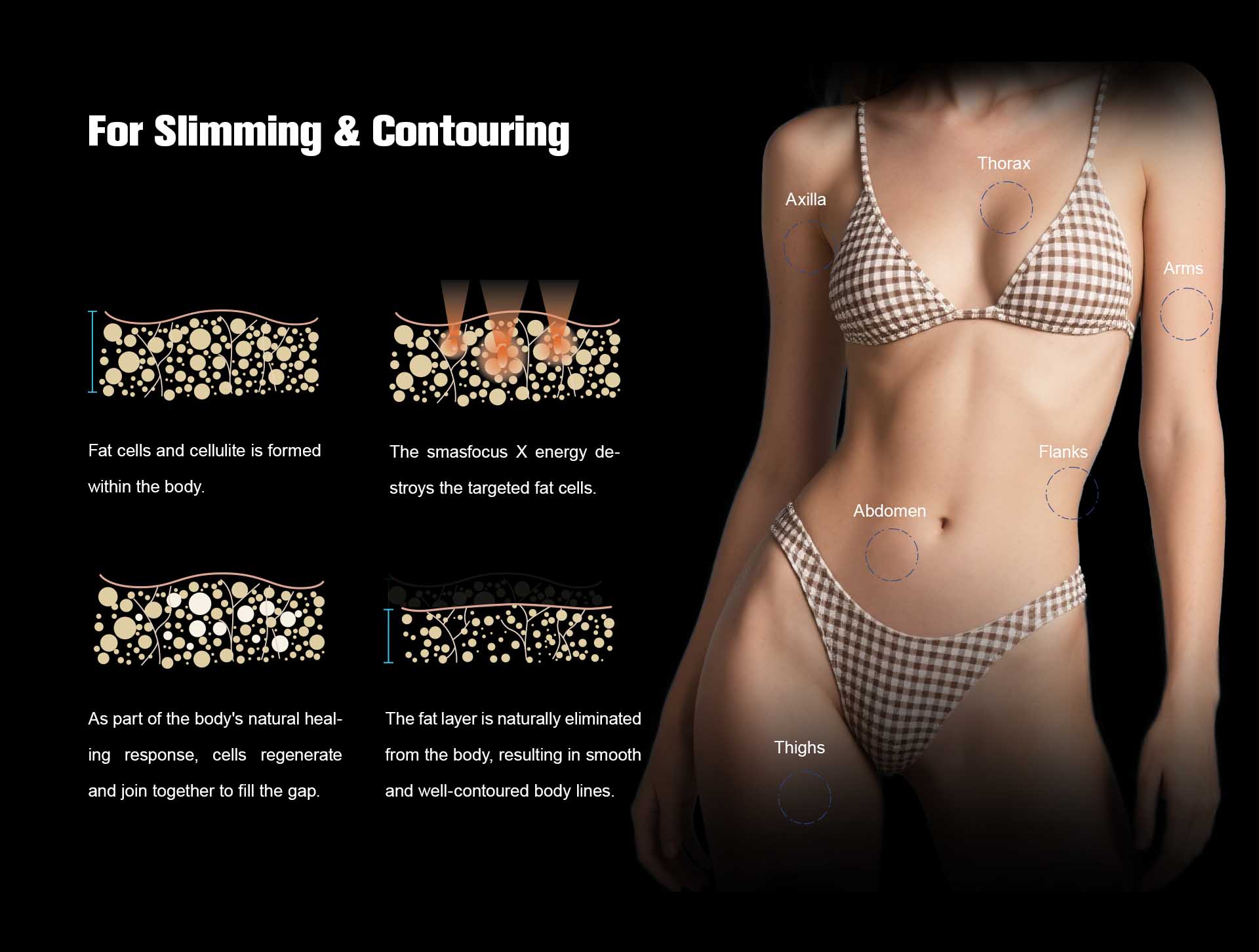 NUBWAY | HIFU(MPT)Machine NUBWAY | HIFU(MPT)Machine