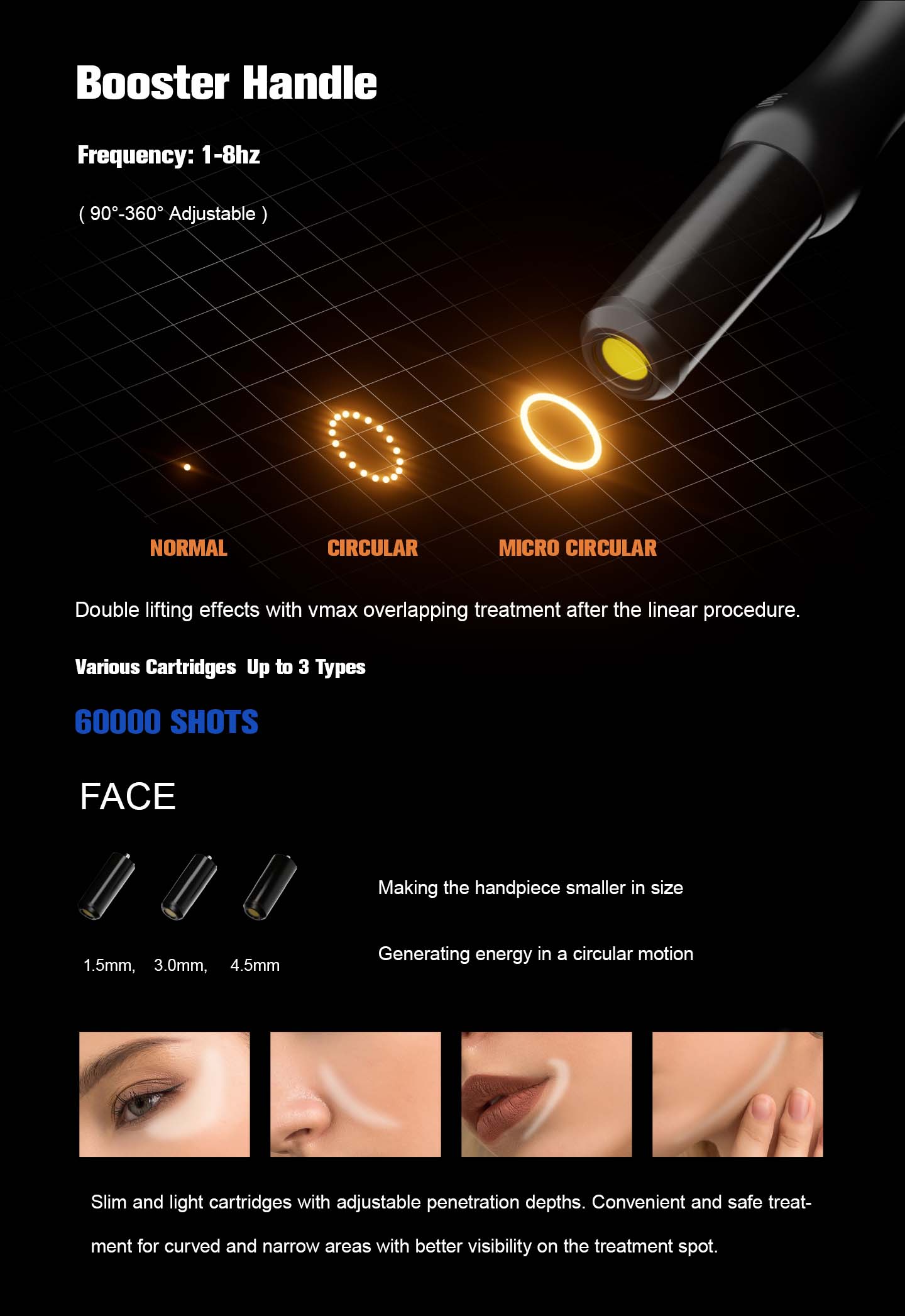 NUBWAY | HIFU（MPT）Machine