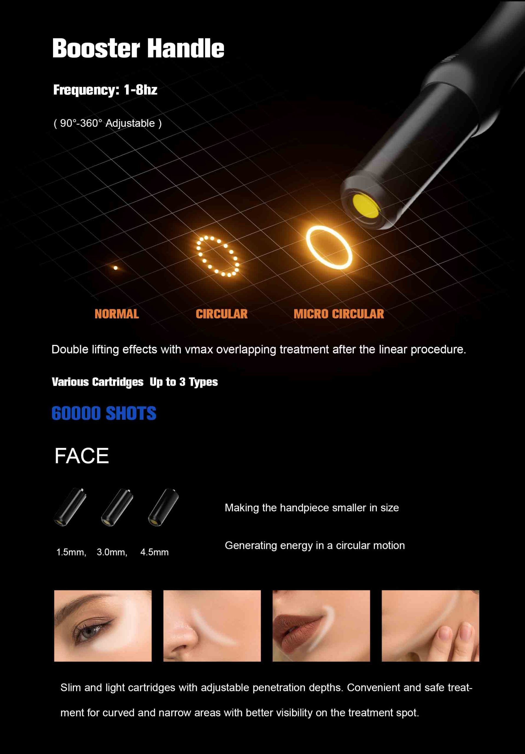 NUBWAY | HIFU（MPT）Machine