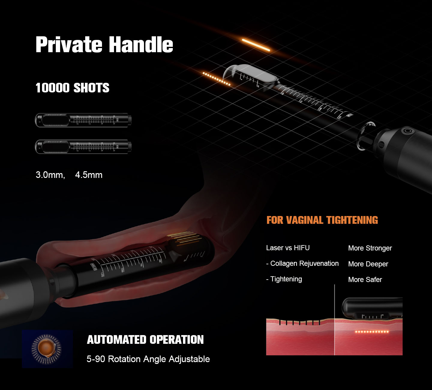 NUBWAY | HIFU（MPT）Machine