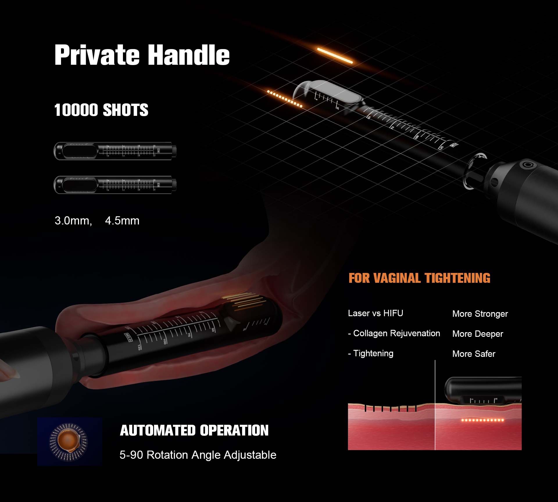 NUBWAY | HIFU(MPT)Machine NUBWAY | HIFU(MPT)Machine
