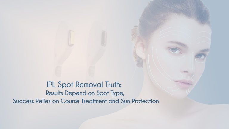 IPL Spot Removal Truth