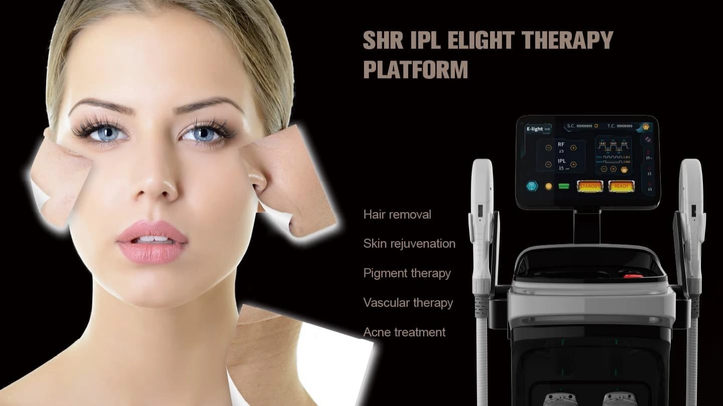 NUBWAY | Laser, IPL or Creams: Which Freckle Removal Method Lasts the Longest? NUBWAY | Laser, IPL or Creams: Which Freckle Removal Method Lasts the Longest?