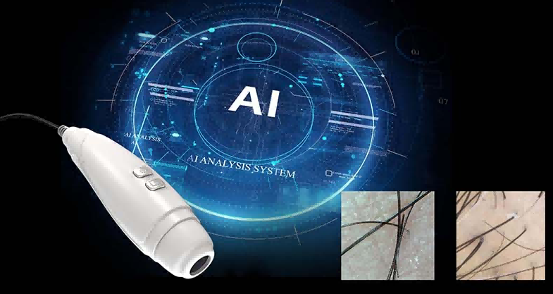 Hair Detector: The Engine for Intelligent Treatment of Laser Hair Removal Device-1