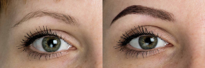 Guidelines for Re-furrowing Eyebrows After Removing the Tattoo: Timing, Process, and Scientific Care-1