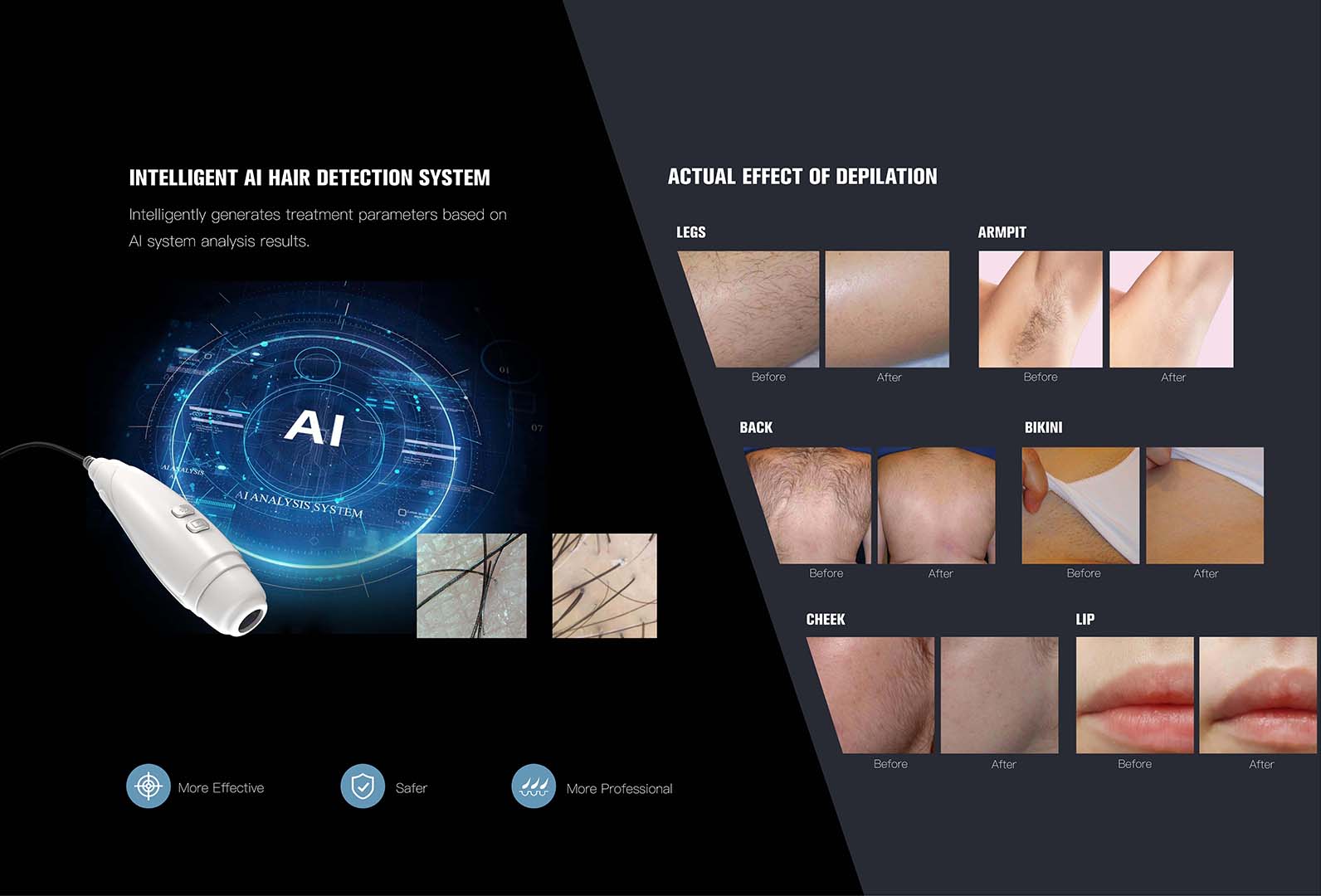 NUBWAY | Android system diode laser NUBWAY | Android system diode laser