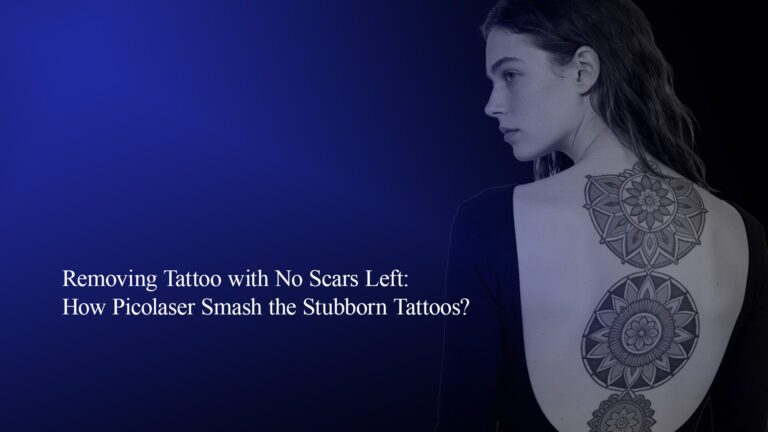 Removing Tattoo with No Scars Left