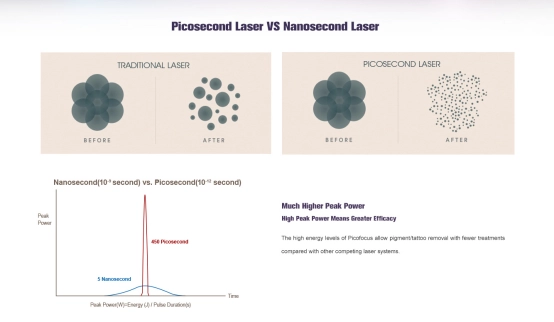 How Fractional Picosecond Laser Works on Acne Scars and Wrinkles-1
