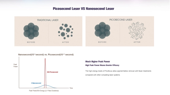 How Picosecond Lasers Boost Collagen & Skin-1