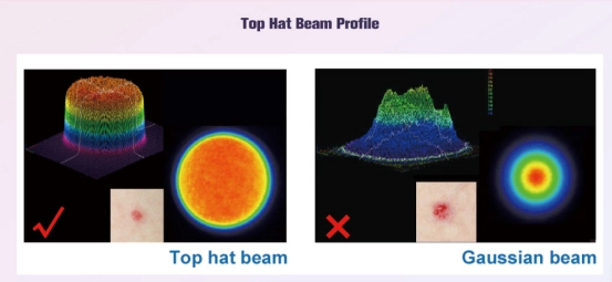 Why the Picosecond Laser Leads the 2026 Shift Toward Advanced Tattoo Removal-1
