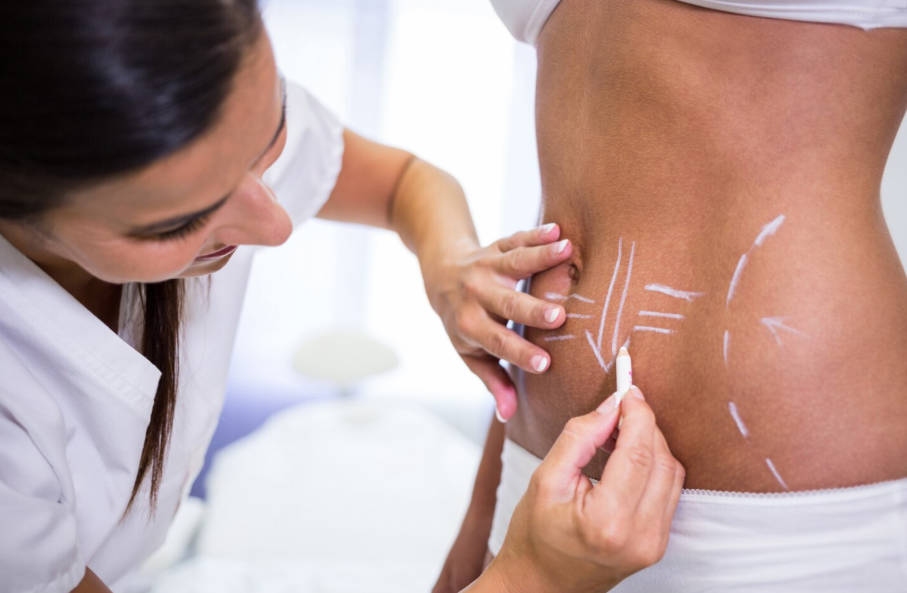 Is Cryolipolysis for Weight Loss or Body Contouring?-1
