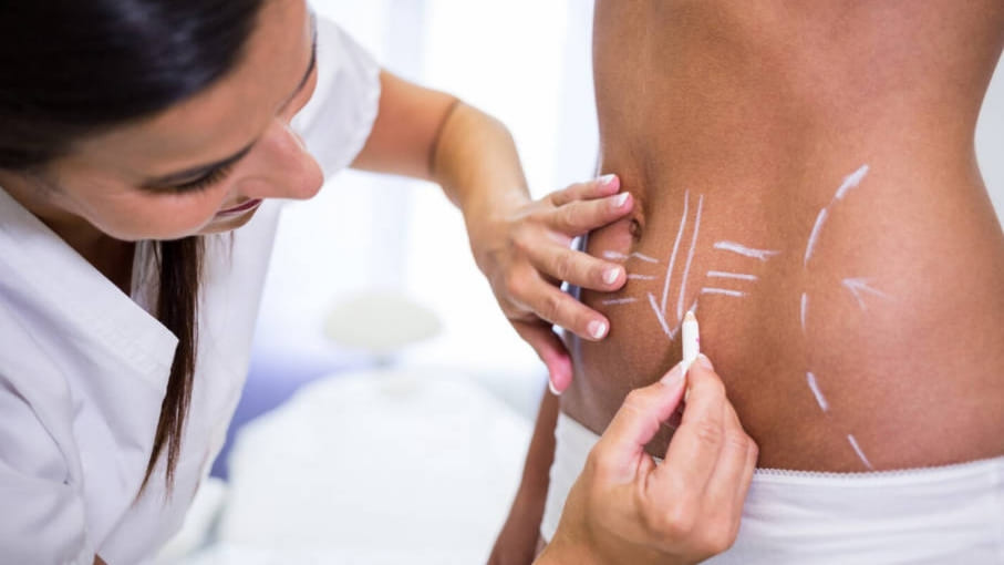 Can Cryolipolysis Slimming Really Permanently Reduce Fat?-