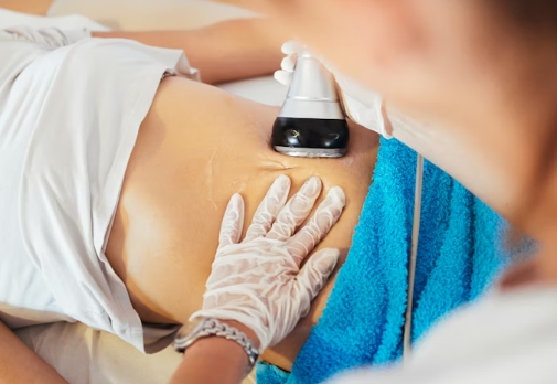 Cryolipolysis Machines (3)