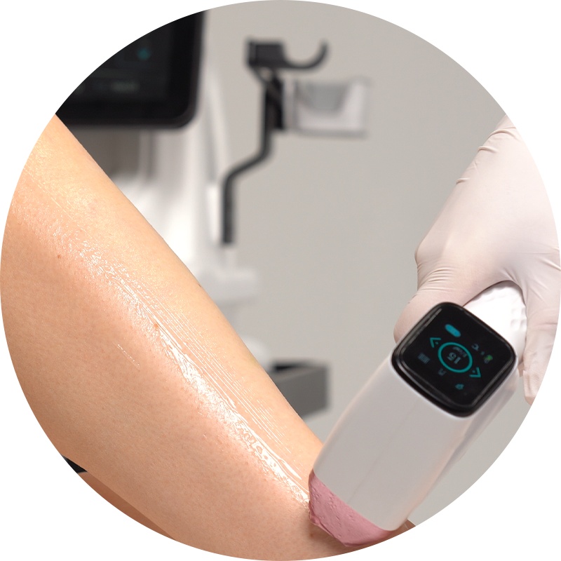 Does Diode Laser Hair Removal Offer Permanent Results?-1 Does Diode Laser Hair Removal Offer Permanent Results?-1