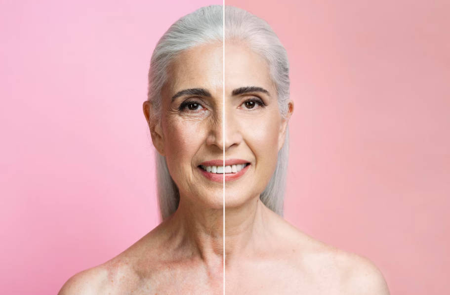 HIFU Before and After: What Results Can You Really Expect?-1